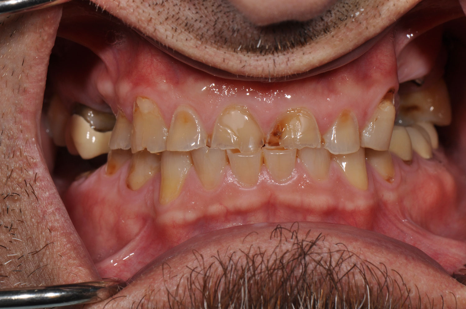 An old pencil drawing of Don Quixote and Sancho Panza sitting on their horses, by Wilhelm Marstrand.