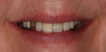 An old pencil drawing of Don Quixote and Sancho Panza sitting on their horses, by Wilhelm Marstrand.