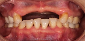 An old pencil drawing of Don Quixote and Sancho Panza sitting on their horses, by Wilhelm Marstrand.